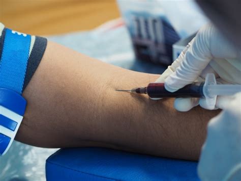 How to draw blood from a patient’s vein as painlessly as possible