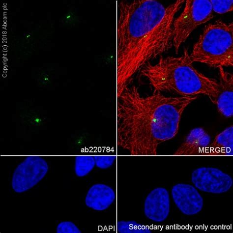 Anti-Pericentrin antibody - Centrosome Marker (ab4448) | Abcam