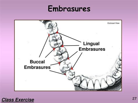 PPT - Dental Terminology Part 2 PowerPoint Presentation, free download - ID:1797765