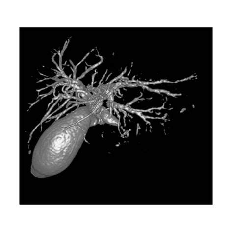 'Gallbladder And Biliary Tree, 3D MRI' Photographic Print - Du Cane Medical | Art.com | Medical ...