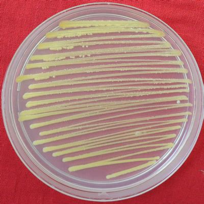 Axenic culture of Pantoea agglomerans | Download Scientific Diagram