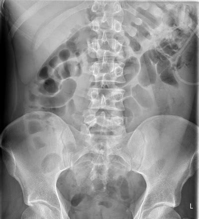 Radiology Quiz 88277 | Radiopaedia.org