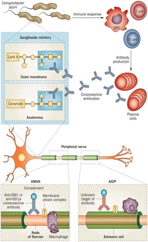 Causes Of Motor Axonal Neuropathy | Webmotor.org