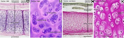 Hyaline cartilage - Definition and Examples - Biology Online Dictionary