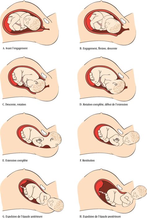 La naissance de mon enfant : la poussée - Rachel Halimi Nurse Drawing, Midwifery Student ...