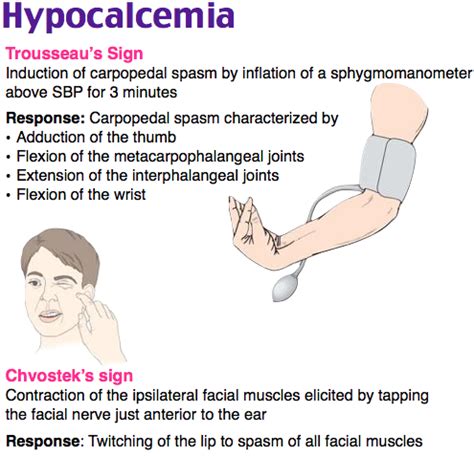 Signos de Hipocalcemia: trousseau y chvostek in 2022 | Nursing ...