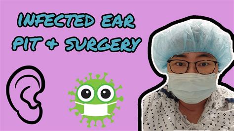 My Experience with an Infected Preauricular Pit & Surgery - Preauricular Tract Removal - YouTube