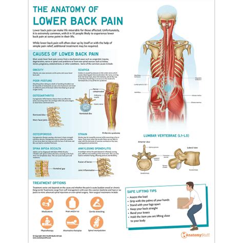 Lumbar Pain Chart