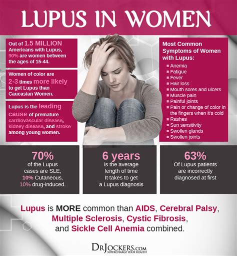 Systemic Lupus: Symptoms, Causes and Support Strategies