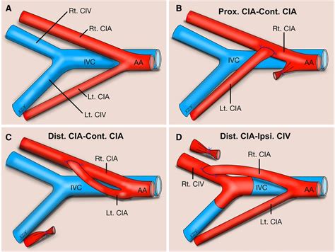 Three types of end-to-side microvascular anastomosis training models ...