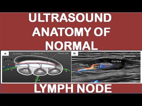 Ultrasound anatomy of normal lymph node - YouTube