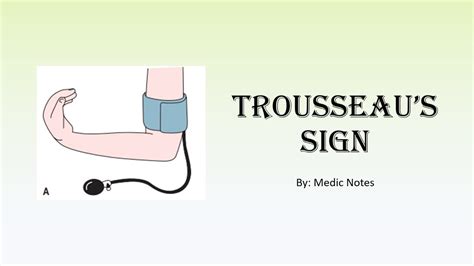 Trousseau's sign causes and pathophysiology - hypocalcemia, respiratory alkalosis ...