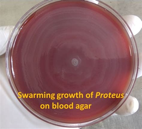 Swarming Growth of Proteus on Blood Agar: Description of Swarming