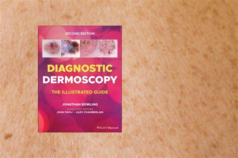 Book review: Diagnostic Dermoscopy: The Illustrated Guide. 2nd Edn – BJGP Life