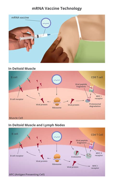 mRNA Vaccines for COVID-19 – How Do They Work? | EBSCO