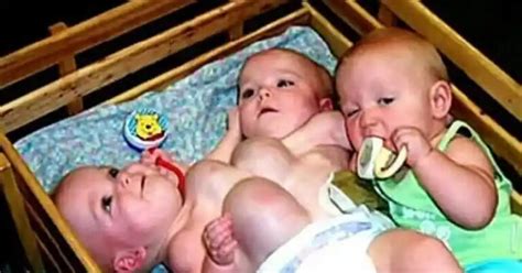 Once conjoined triplets, now 17 years old – Finance Blog