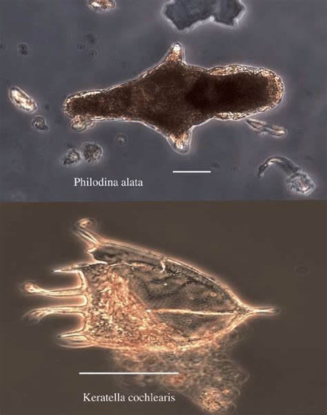 Rotifer species previously recorded on the Antarctic continent,... | Download Scientific Diagram