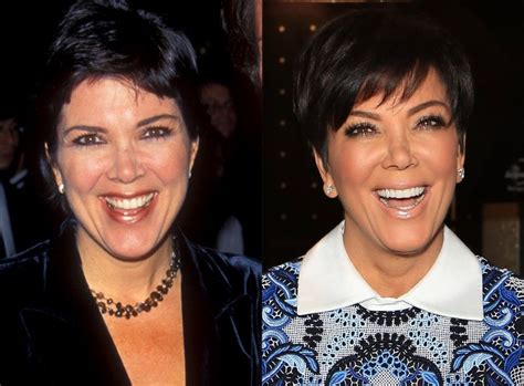 Kris Jenner perfect plastic surgery for 59 years old mother!