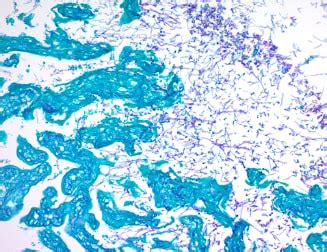 PAS Stain Kit (Fungus, Periodic Acid Schiff Stain) (ab245886) | Abcam