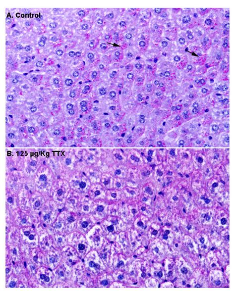 Periodic acid-Schiff (PAS) stained liver sections from control mice and... | Download Scientific ...