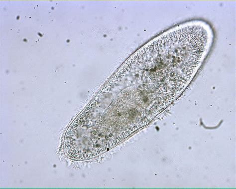 Live Paramecium 100X: General Biology Lab: Loyola University Chicago