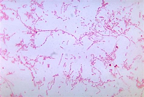 Fusobacterium necrophorum; Sphaerophorus necrophorus