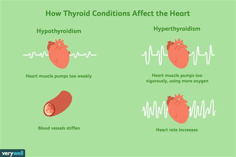 How Does Thyroid Disease Affect the Heart? (2022)