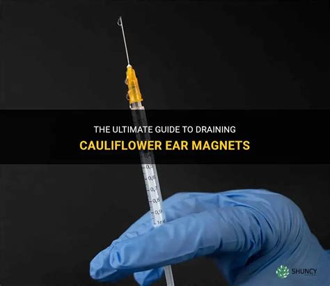 The Ultimate Guide To Draining Cauliflower Ear Magnets | ShunCy