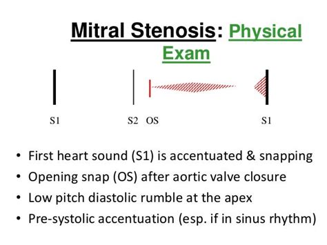 Mitral stenosis