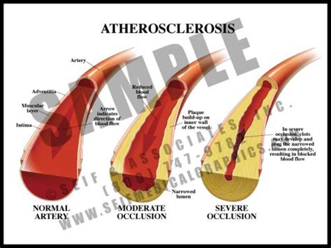 The Aorta and Its Branches - S&A Medical Graphics