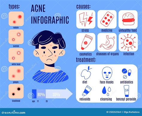 Man Problem Skin Infographic. Stop Acne Educational Poster Stock Vector ...