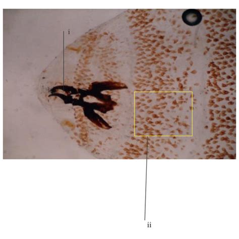 (a) Length of Cordylobia anthropophaga larvae in millimeters (12 mm);... | Download Scientific ...