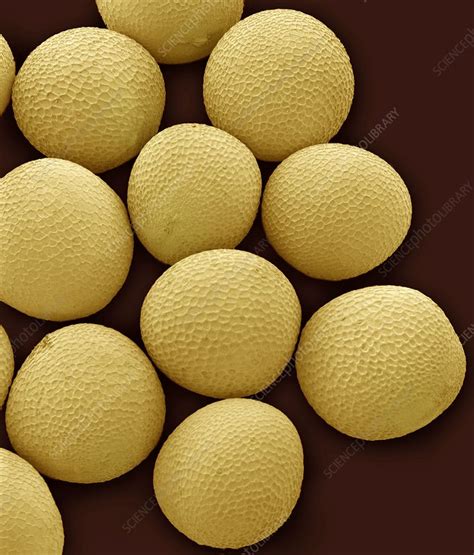 Black mustard seeds, SEM - Stock Image - C002/0967 - Science Photo Library