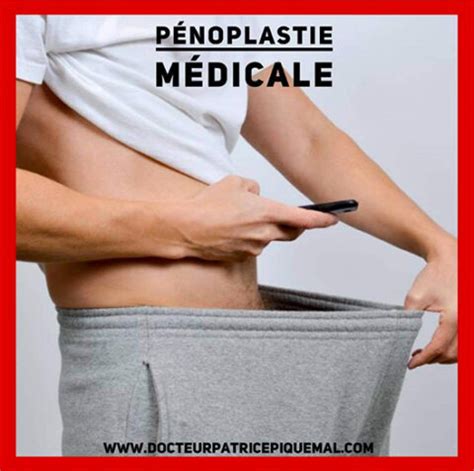 MEDICAL PENOPLASTY - Docteur Patrice piquemal