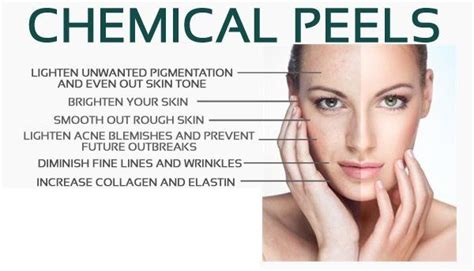 Chemical Peels Schertz, TX | Rejuvenating Transformations Medical Spa