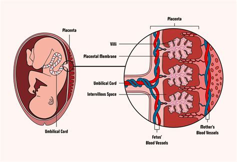 Placenta Anterior Upper Segment Grade 3 Maturity Means - king gambit