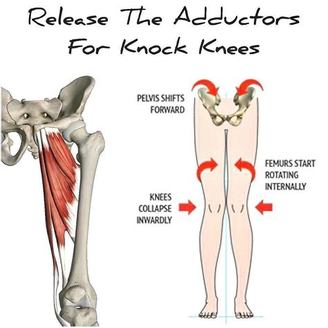 4372 Likes 170 Comments Vinh Pham (@vinnierehab) on Instagram: TIGHT ADDUCTORS = KNOCK | Knock ...