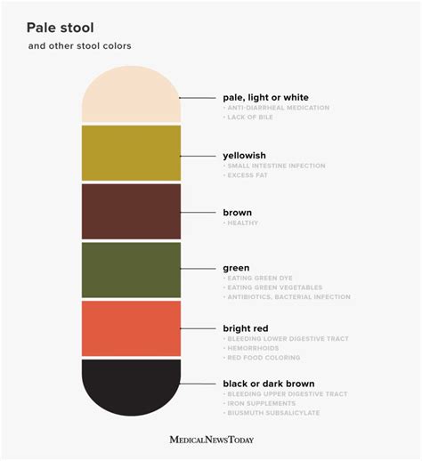 Pale stool: causes, diagnosis, and treatment