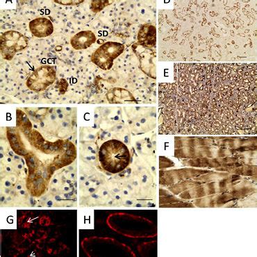 GLUT4 immunodetection in rat and mouse submandibular gland with a... | Download Scientific Diagram