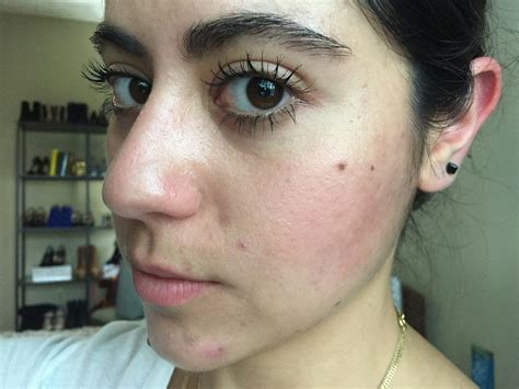 21 Things People With Oily Skin Are Sick Of Hearing