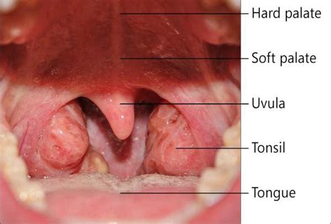 Throat Cancer Symptoms