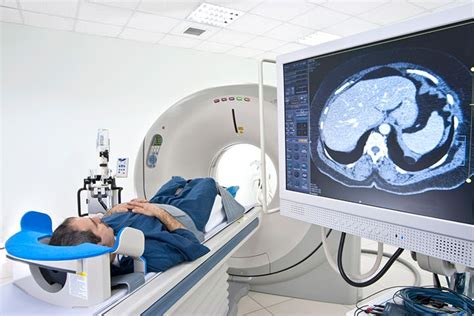 No DNA Damage Seen With Single Low-Dose CT Scan | MedPage Today