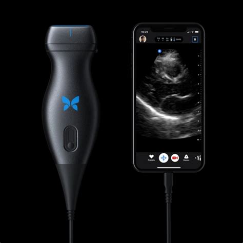 This affordable, portable ultrasound device works with a smartphone | Ultrasound, Medical ...