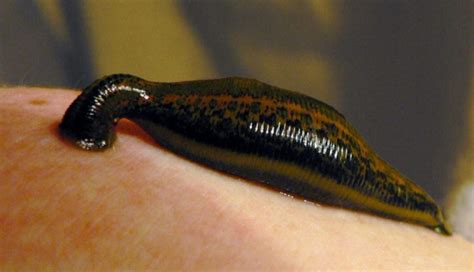 People Are Keeping Parasitic Leeches as Pets, And Letting Them Drink Their Blood | Table for Change