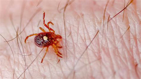 Tick Bite Pictures Symptoms What Does A Tick Bite Look Like? | lupon.gov.ph