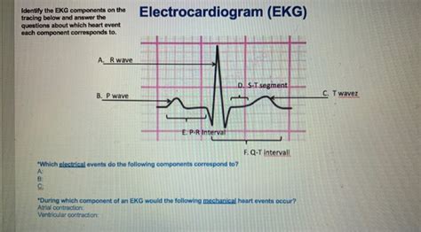 Solved Electrocardiogram (EKG) Identify the EKG components | Chegg.com