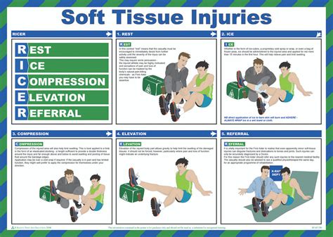 Soft Tissue Injuries Poster - Preventing and Managing Soft Tissue Injuries: A Comprehensive ...