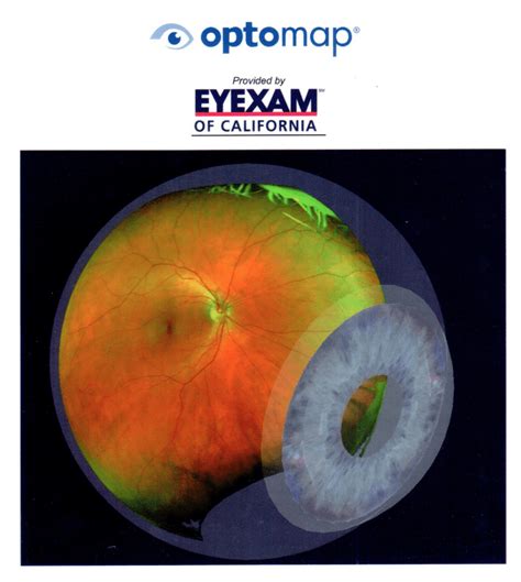 Optomap Retinal Exam - New York Style Optometry