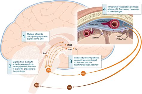 Pathophysiology Of Headaches