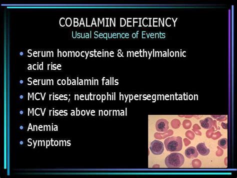 Megaloblastic anemia - online presentation